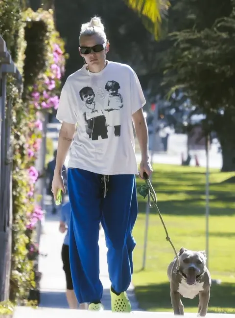 Lauren Wasser and Her Adorable Dog Take a Stroll in Los Feliz 08-25-2025